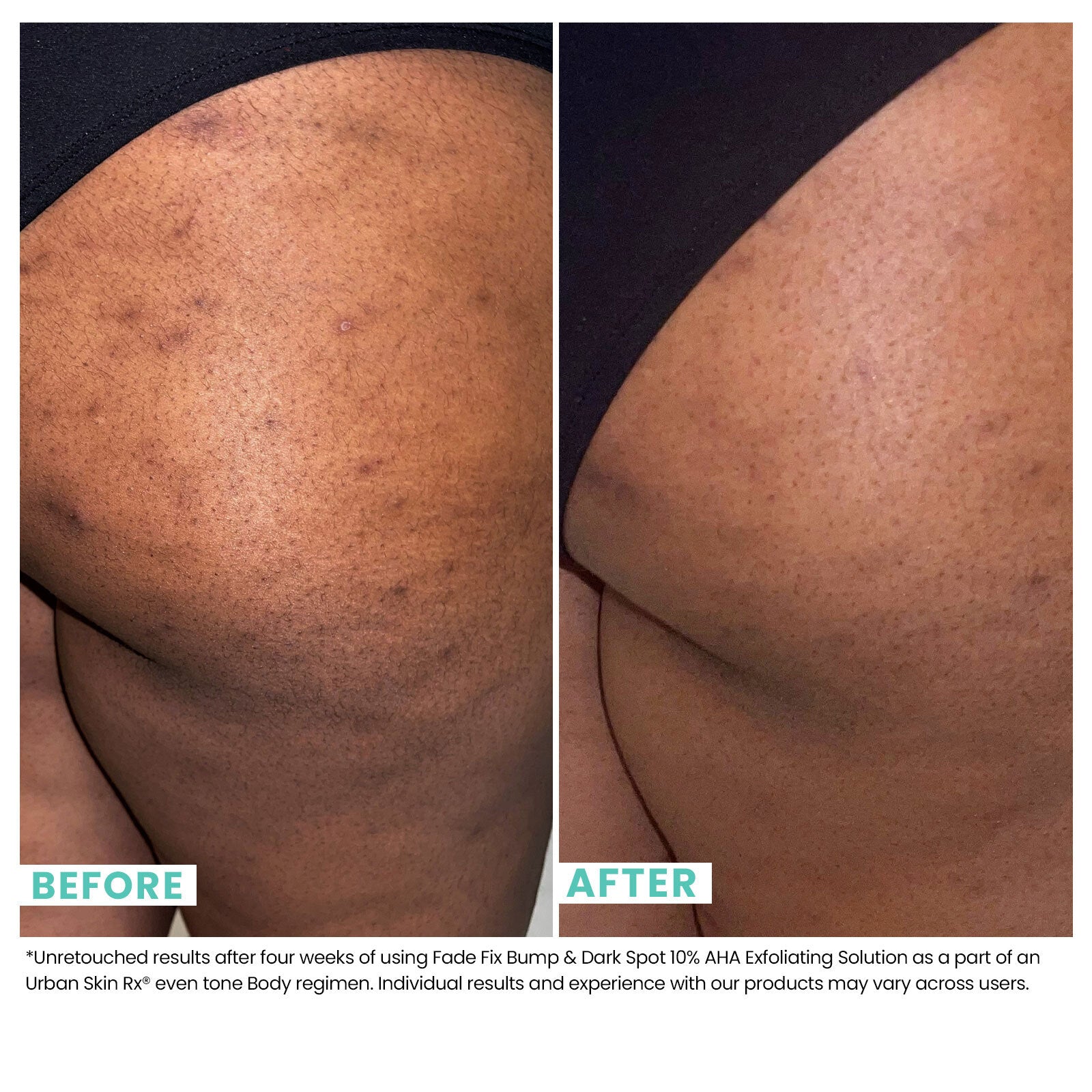 Even Tone Body Renewal Kit