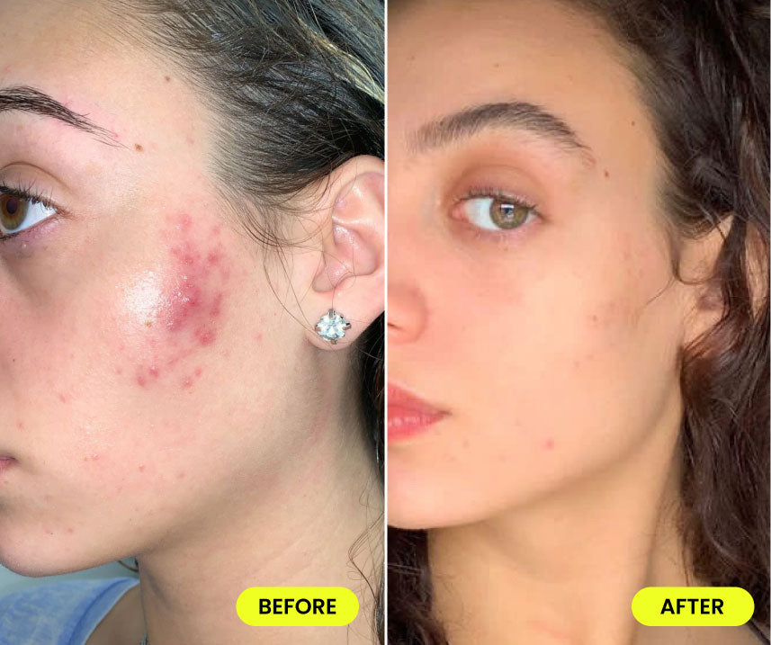 before and after image