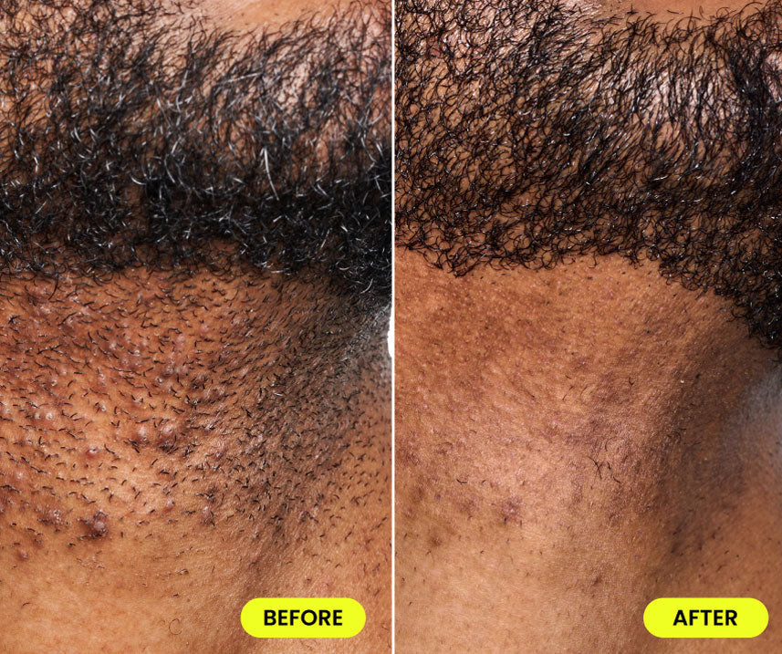 before and after image
