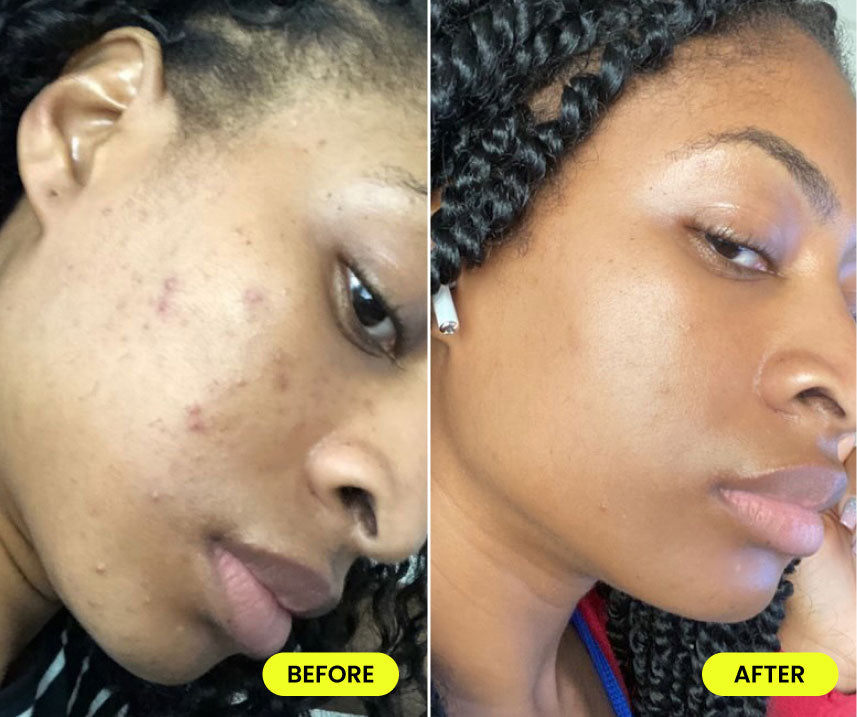 before and after image