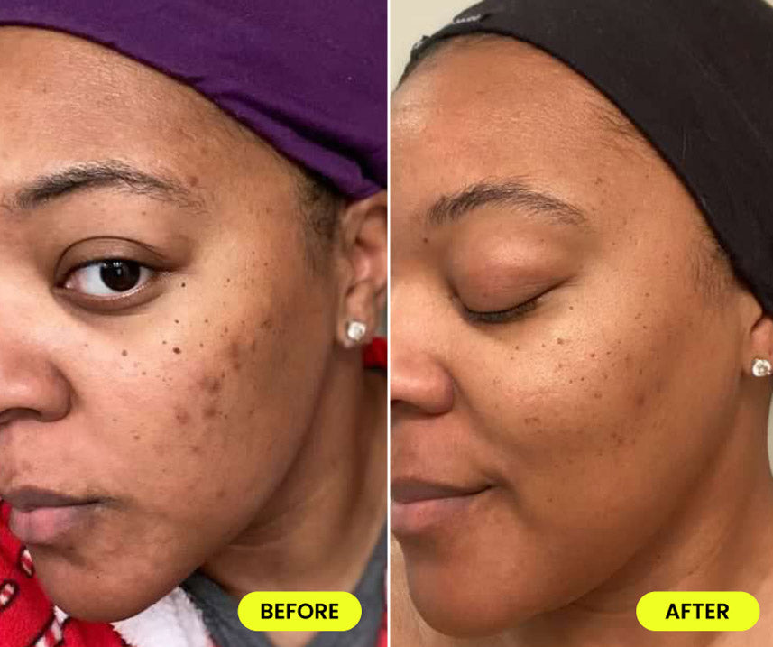 before and after image