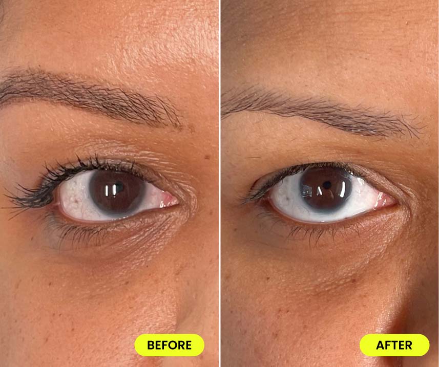 before and after image