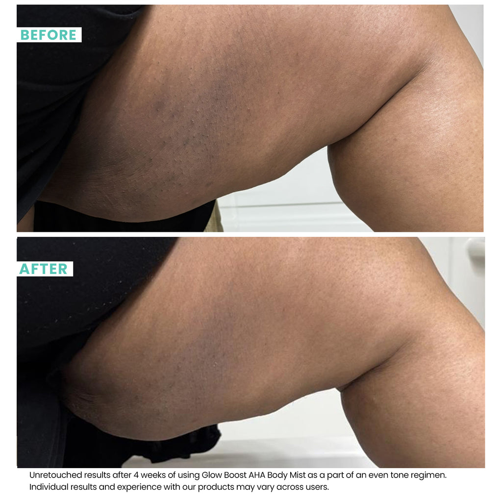 after glutathione injection A Beginner's Guide to Glutathione Injections: What to Expect