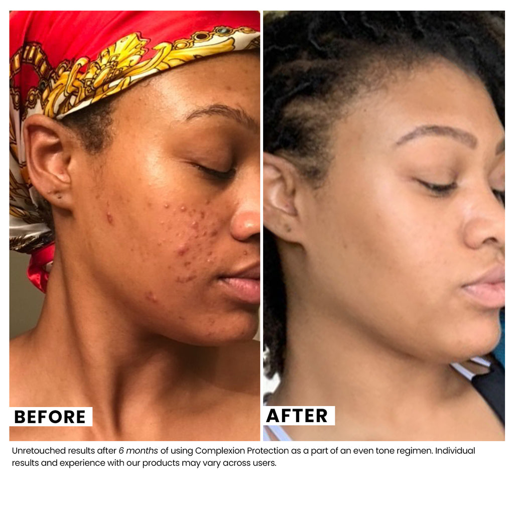 The Complexion Protection | Urban Skin Rx Moisturizer With Spf