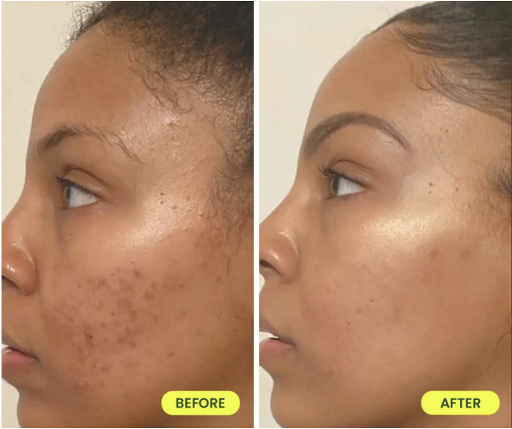 before and after image