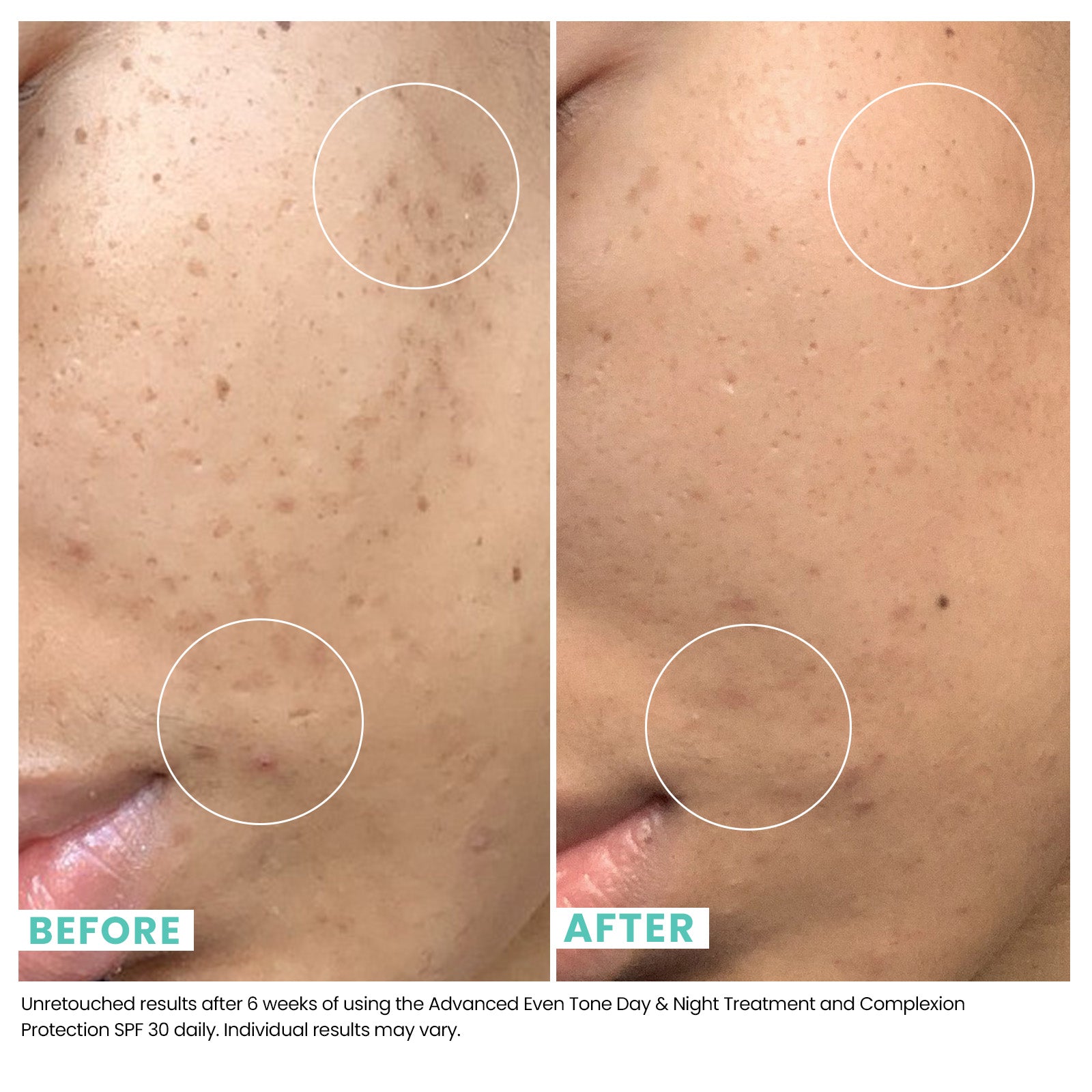 Comparison of woman's skin before and after using USRx even tone regimen