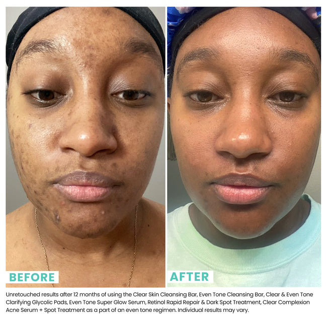 before and after image