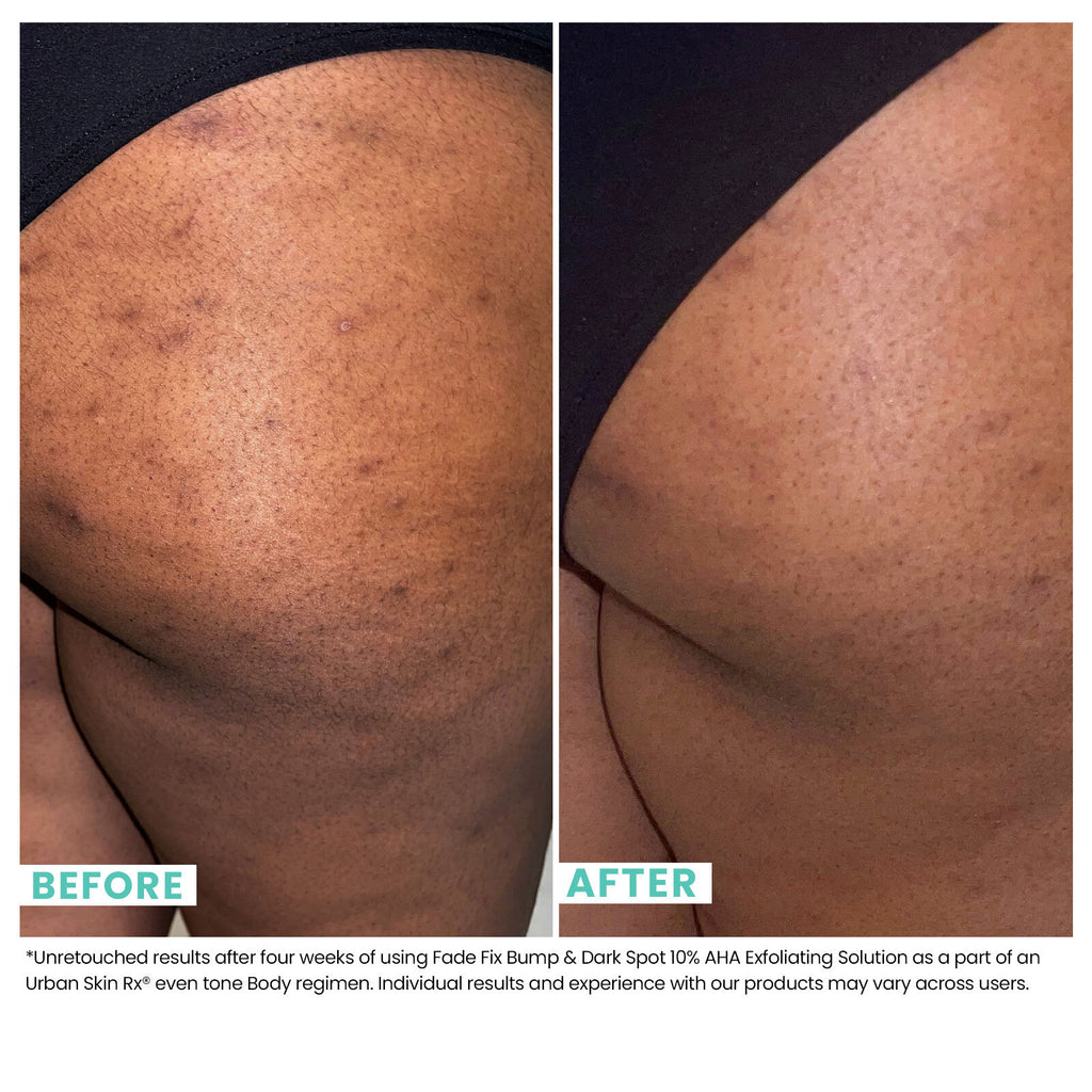 Fade Fix Bump & Dark Spot 10% AHA Exfoliating Solution