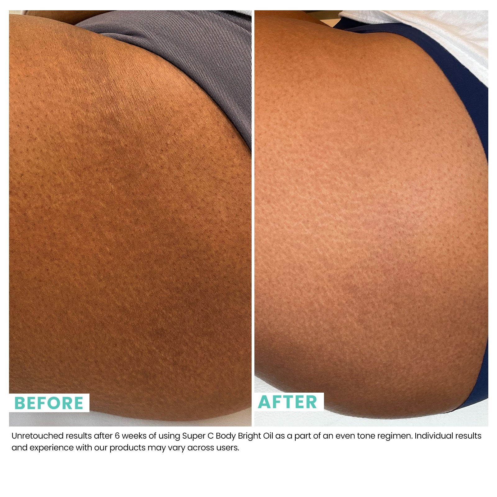 Super C Body Bright Oil | Urban Skin Rx