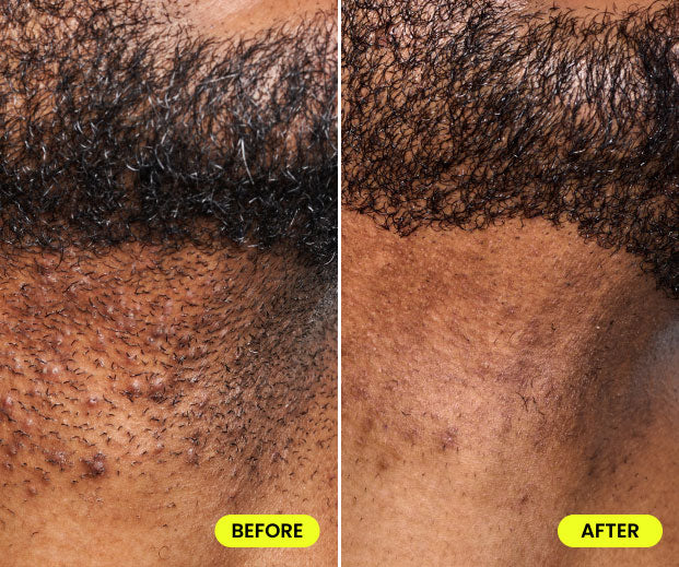 before and after image