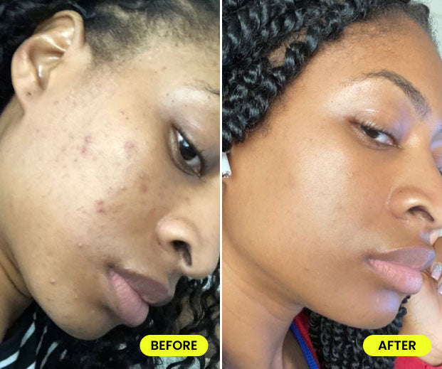 before and after image