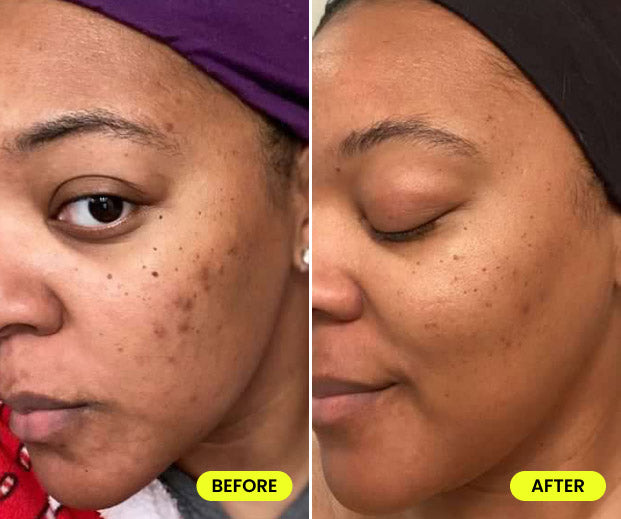 before and after image