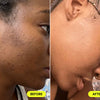 Comparison of woman's skin before and after using USRx Retinol Rapid Repair