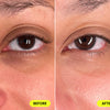 Comparison of woman's under eye before and after using USRx VitalEyez