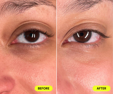 Comparison of woman's under eye before and after using USRx VitalEyez