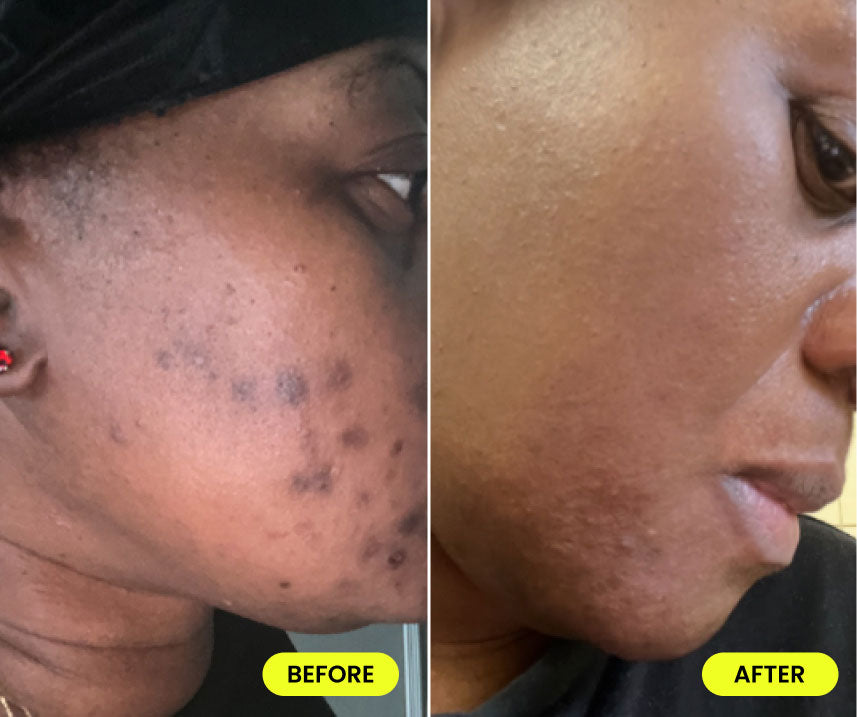before and after image