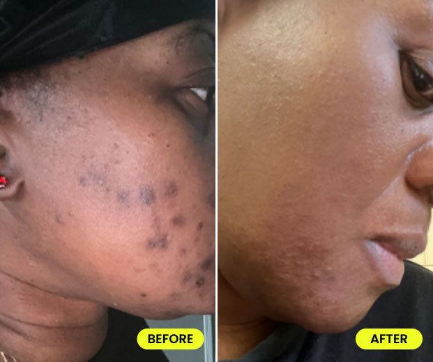 before and after image