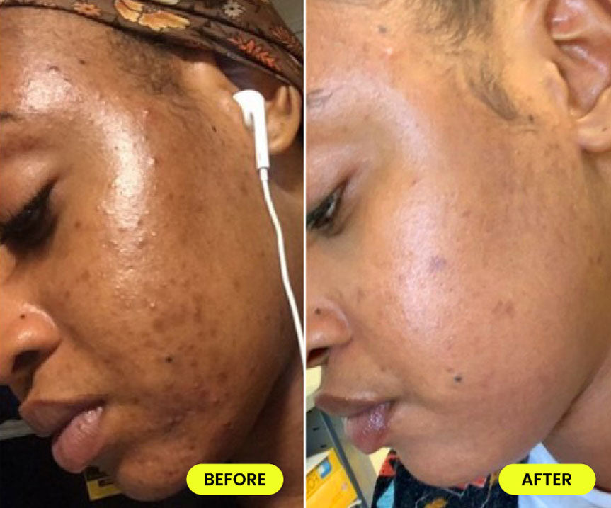 before and after image
