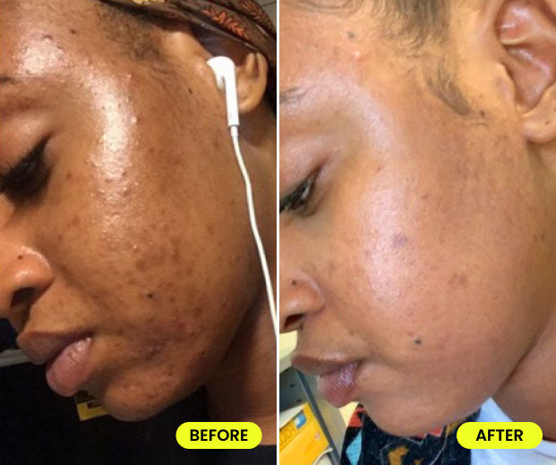 before and after image