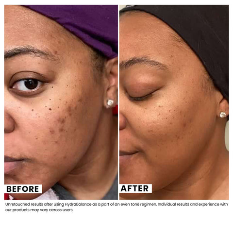 Woman's skin before and after using USRx even tone regimen
