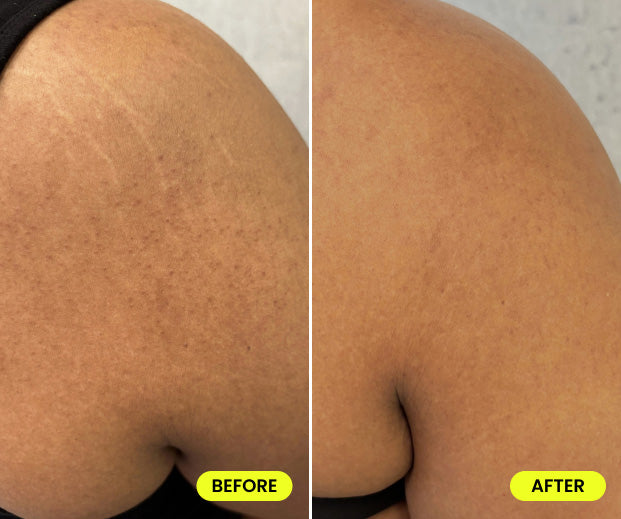 before and after image