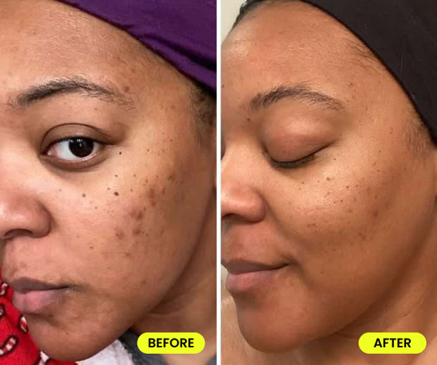 before and after image