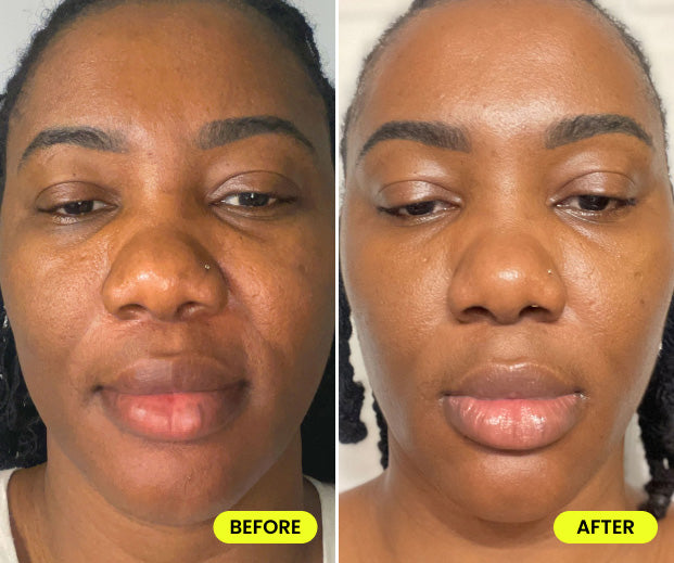 before and after image