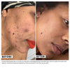 Woman's skin before and after using USRx even tone regimen