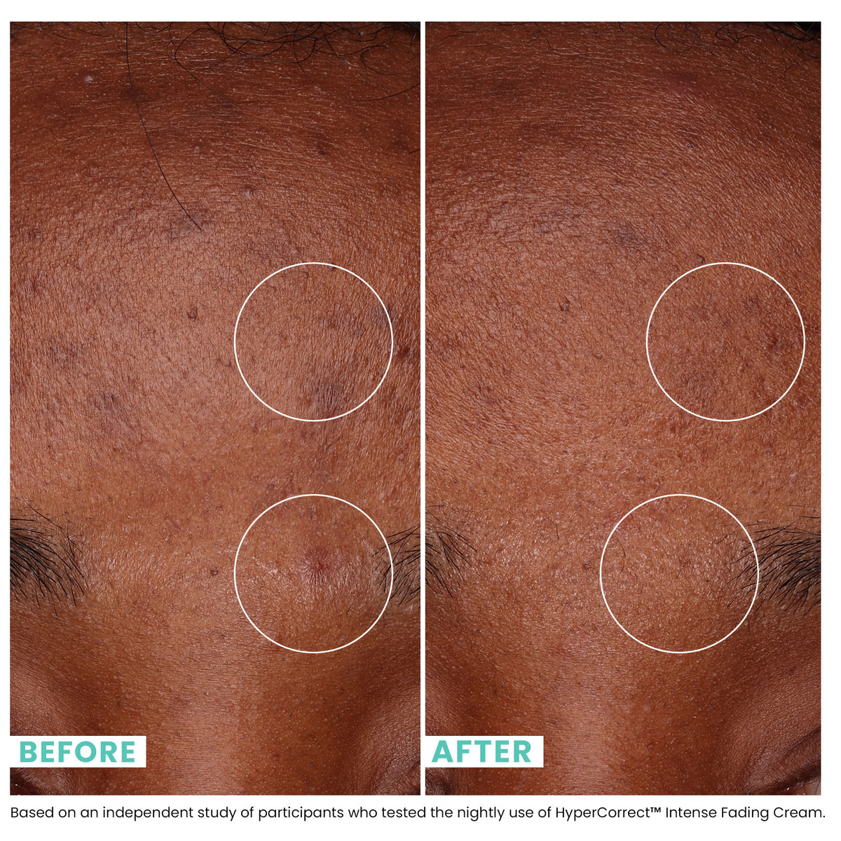 Urban Skin Rx - Skin Care From The Melanin Experts