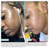 Comparison of woman's skin before and after using Urban Skin Rx Reti-Glow Gentle Resurfacing Night Oil on her face