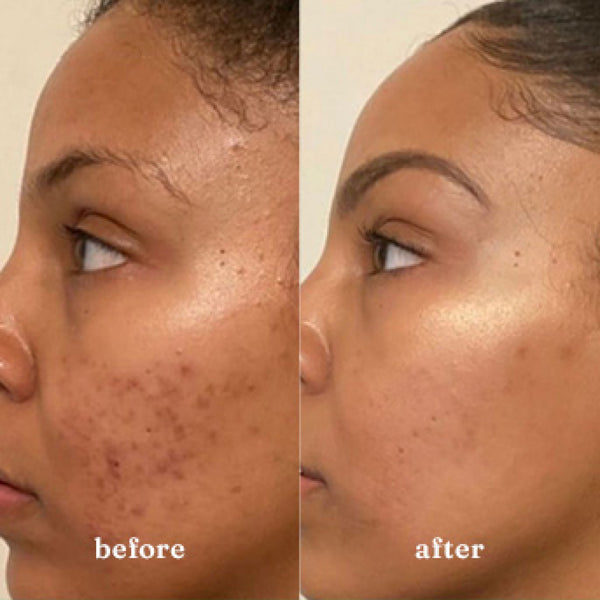 Before and After Image