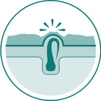 Hair Bump Relief Step 1 image