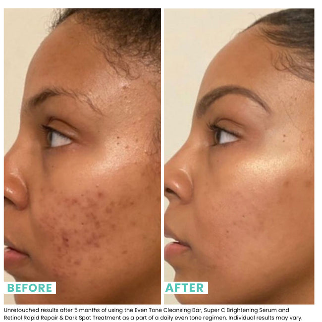 before and after image